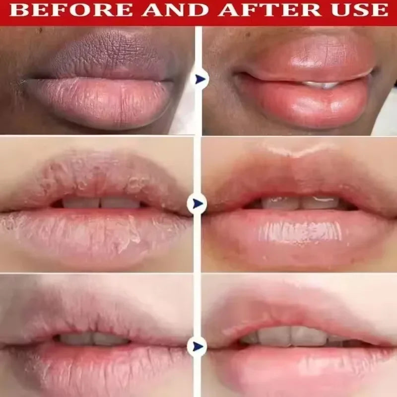 Melanin Lip Mask – Brightening Lip Balm & Serum