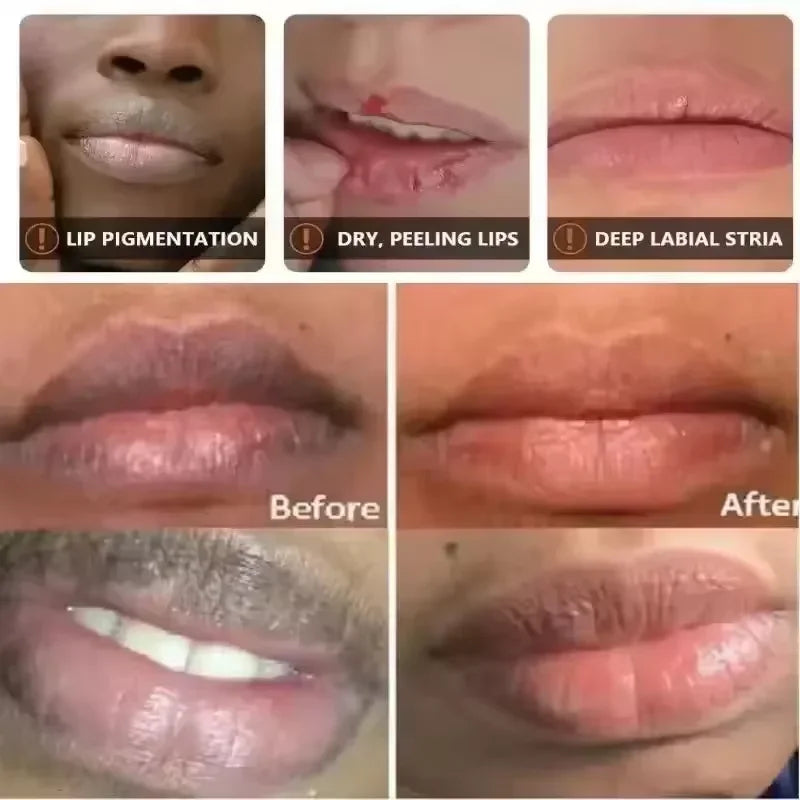 Melanin Lip Mask – Brightening Lip Balm & Serum